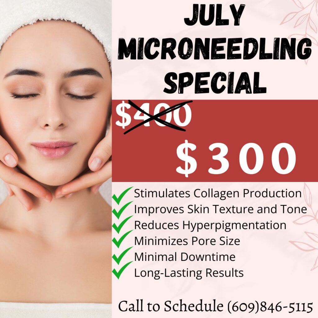 Microneedling Special July
